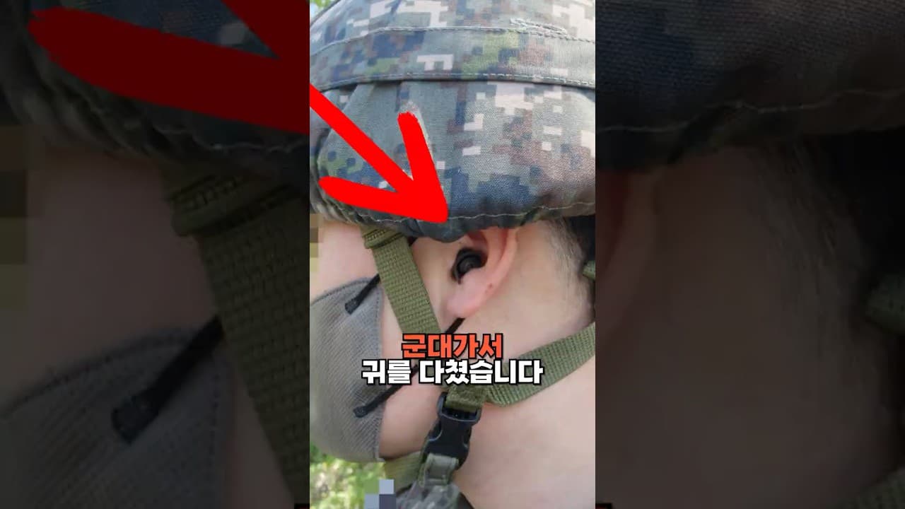군대 가서 귀를 다쳤습니다